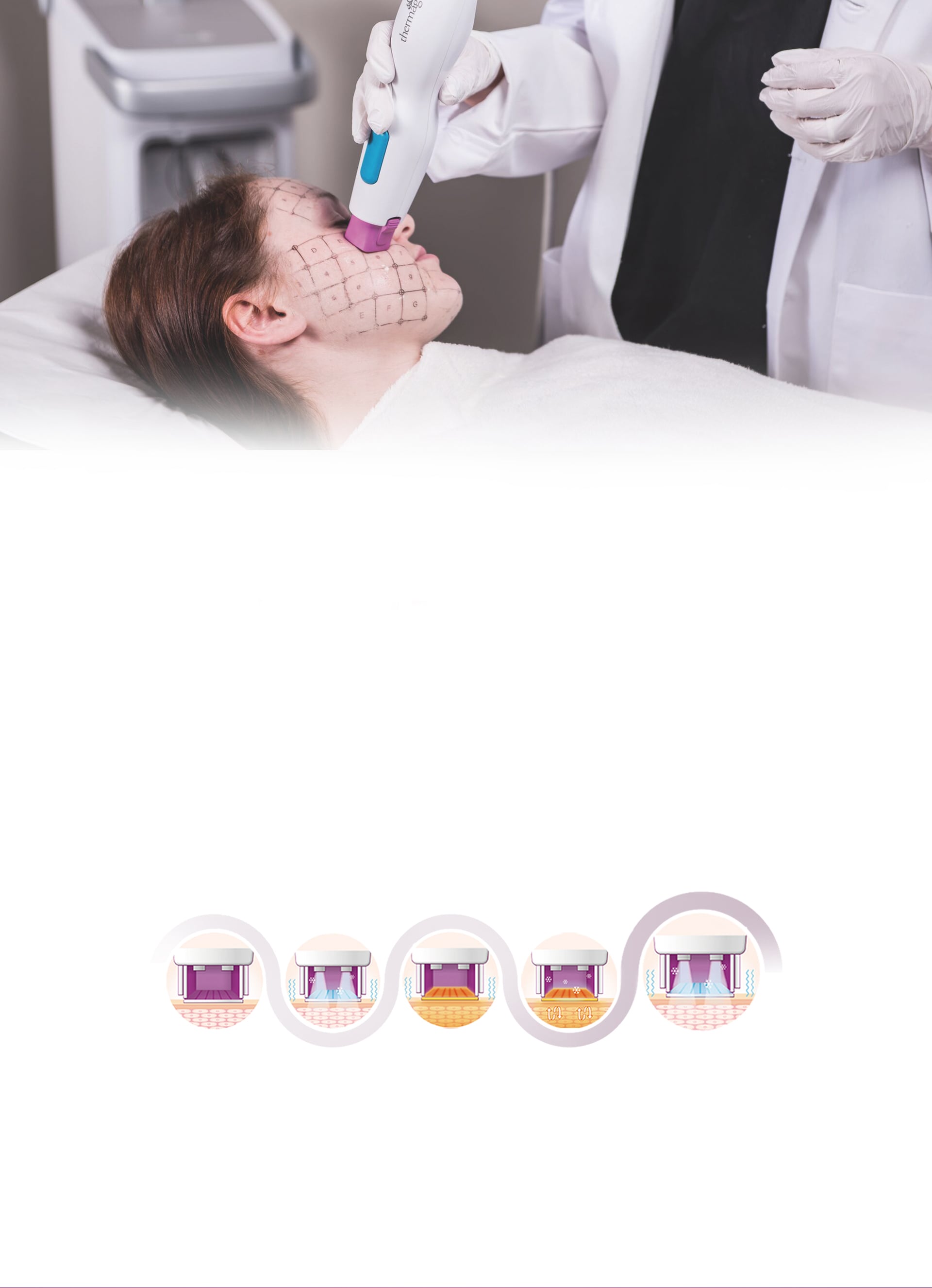 熱瑪吉FLX 療程原理及流程