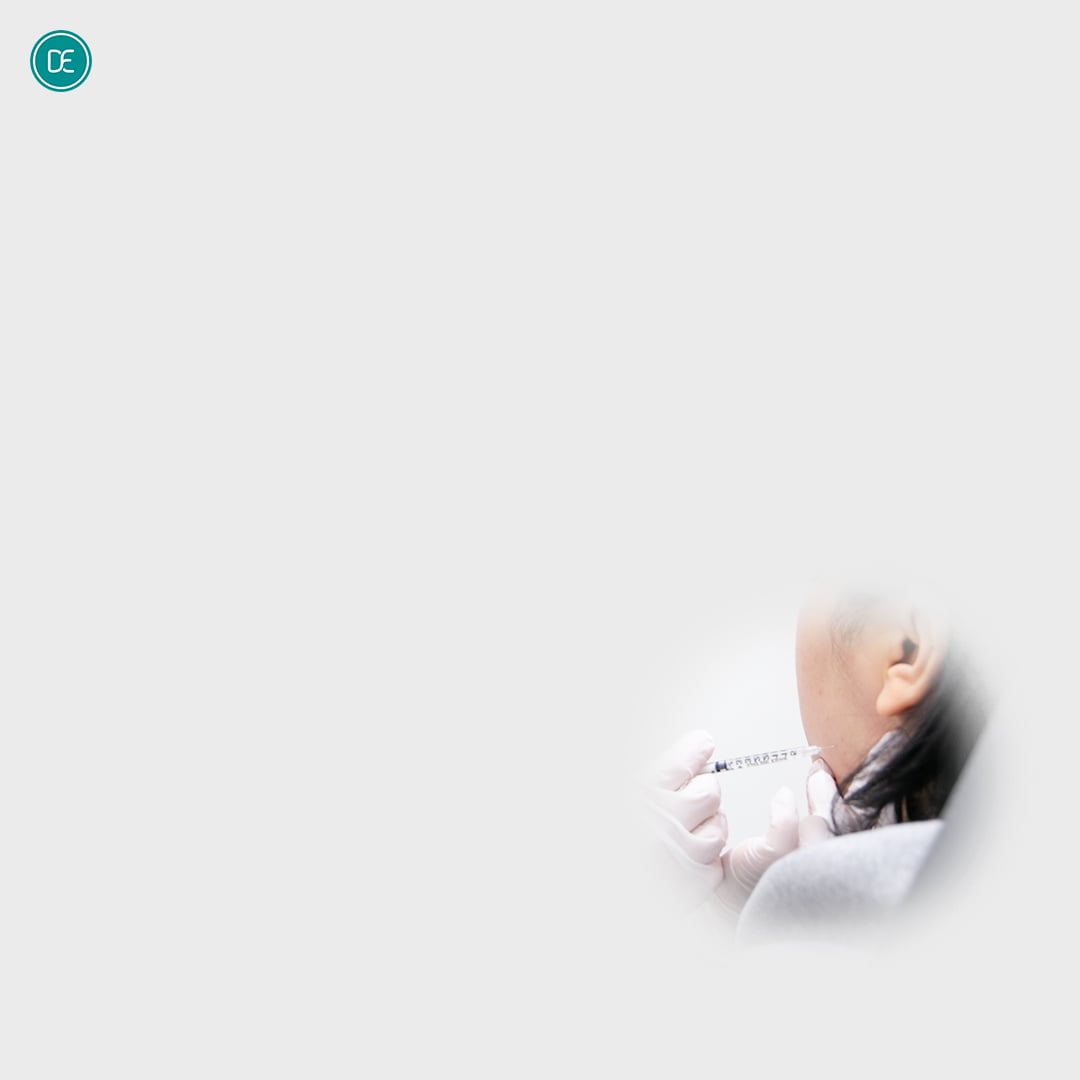 鵝蛋臉輪廓針