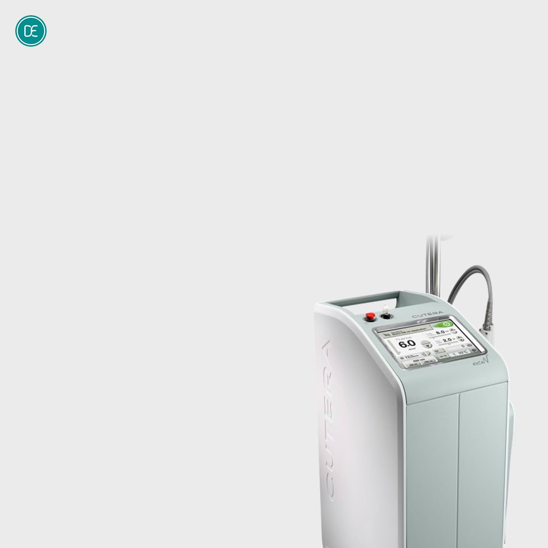 Excel V雷射