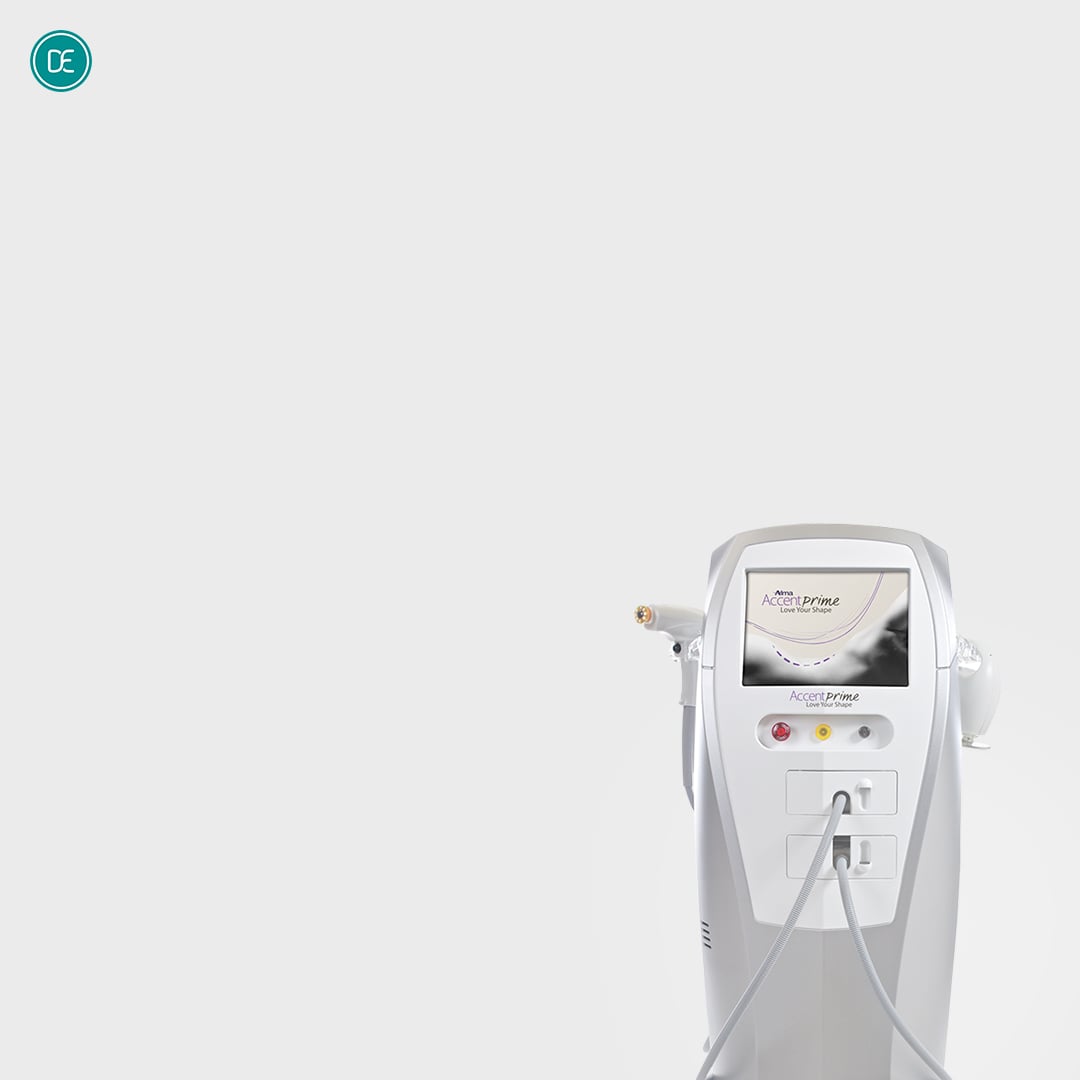Accent Prime